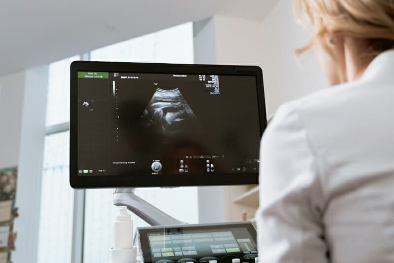 monitor fetal - Tococardiógrafos en México para monitorización fetal